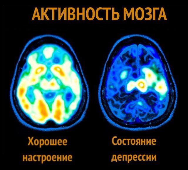 Состояние мозга